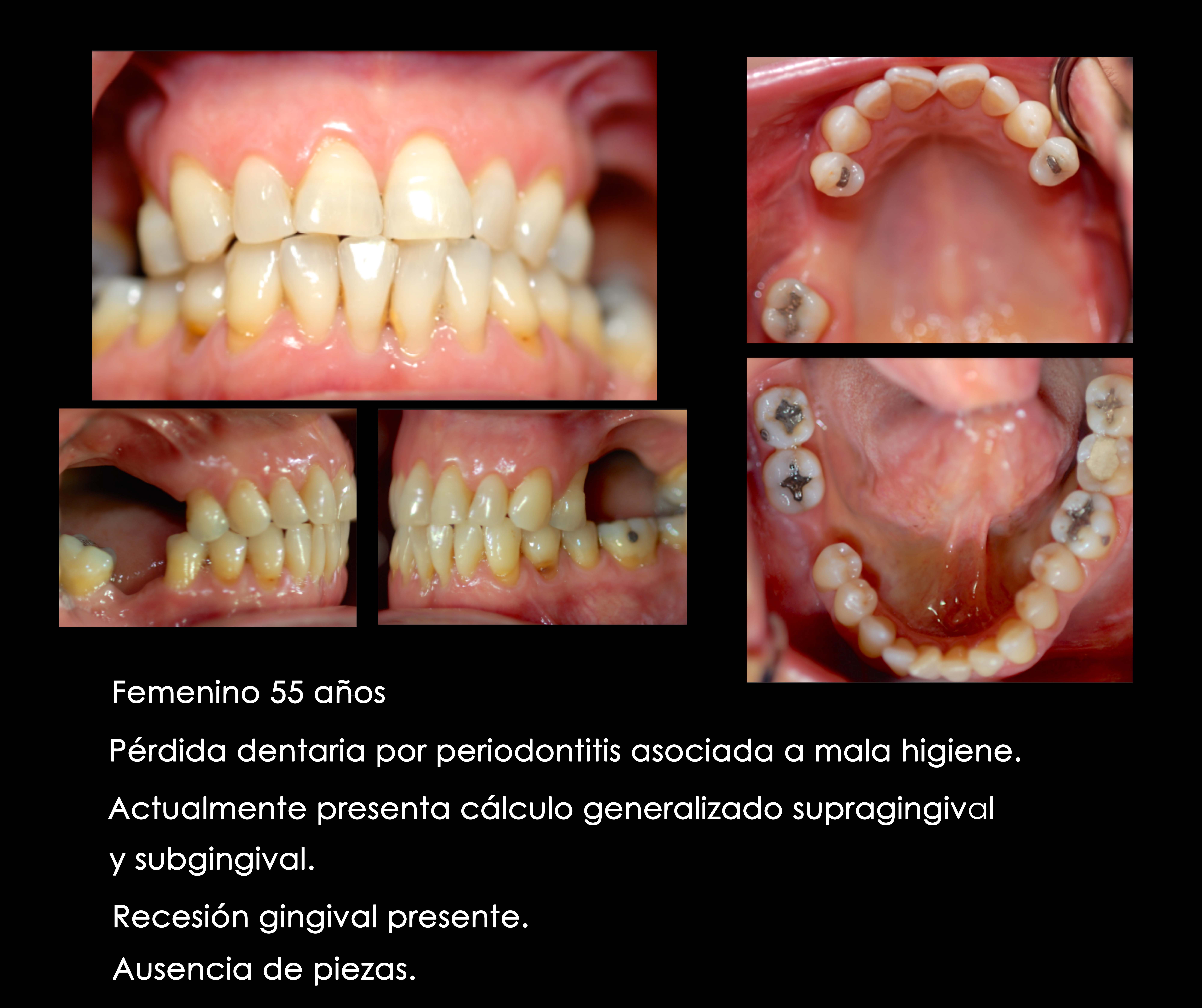 Articulador Dental Axiomath