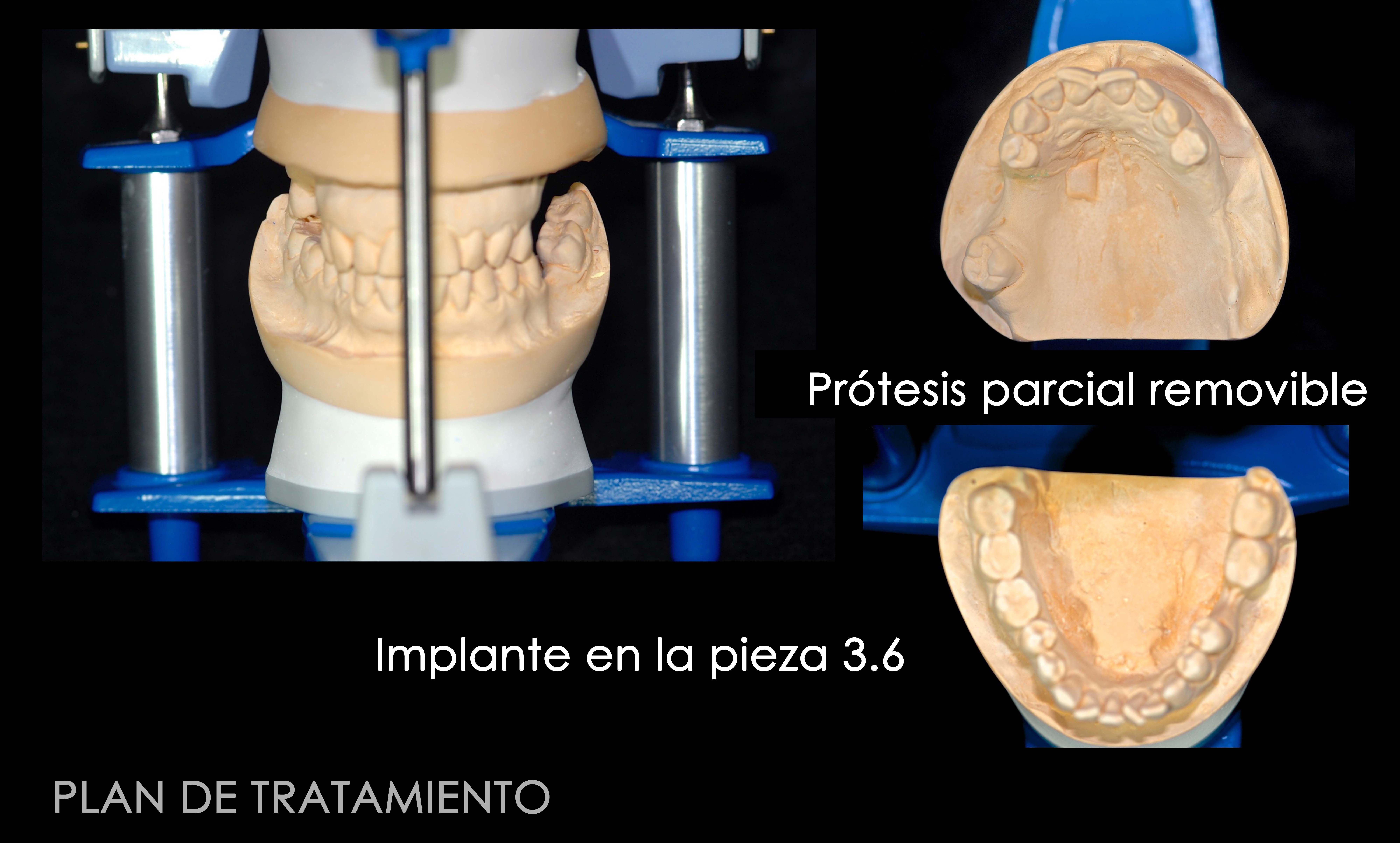 Articulador Dental Axiomath