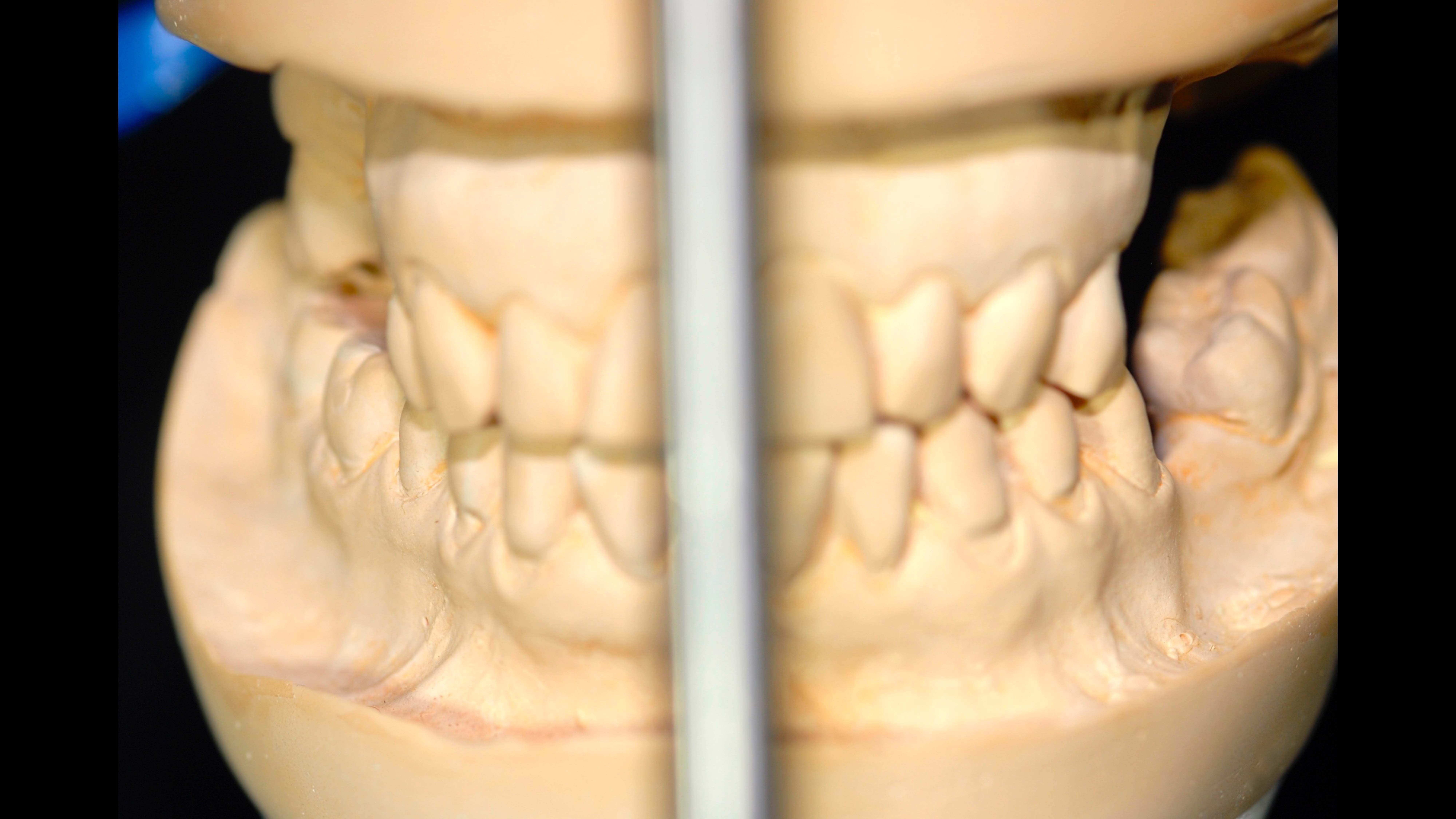 Articulador Dental Axiomath