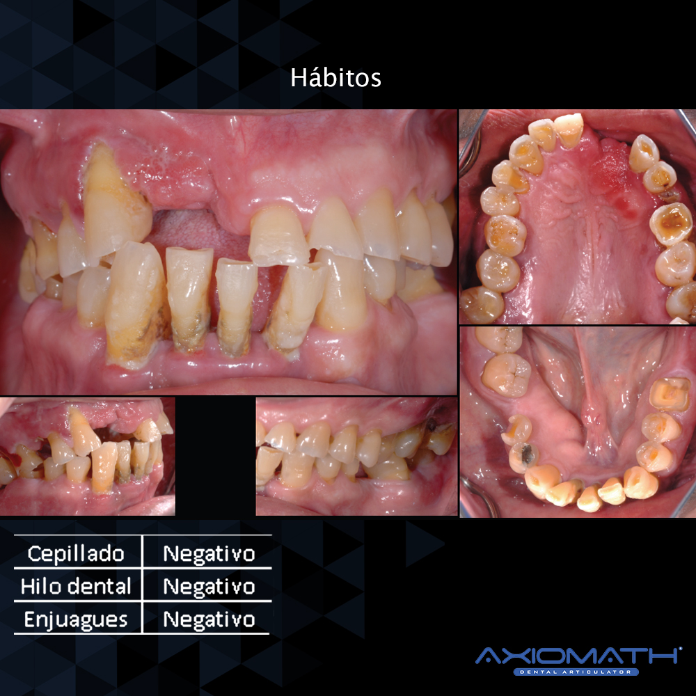 Articulador Dental Axiomath