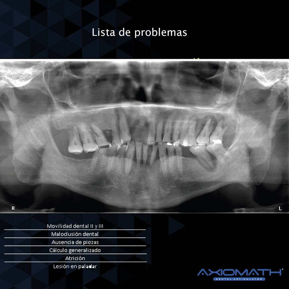 Articulador Dental Axiomath