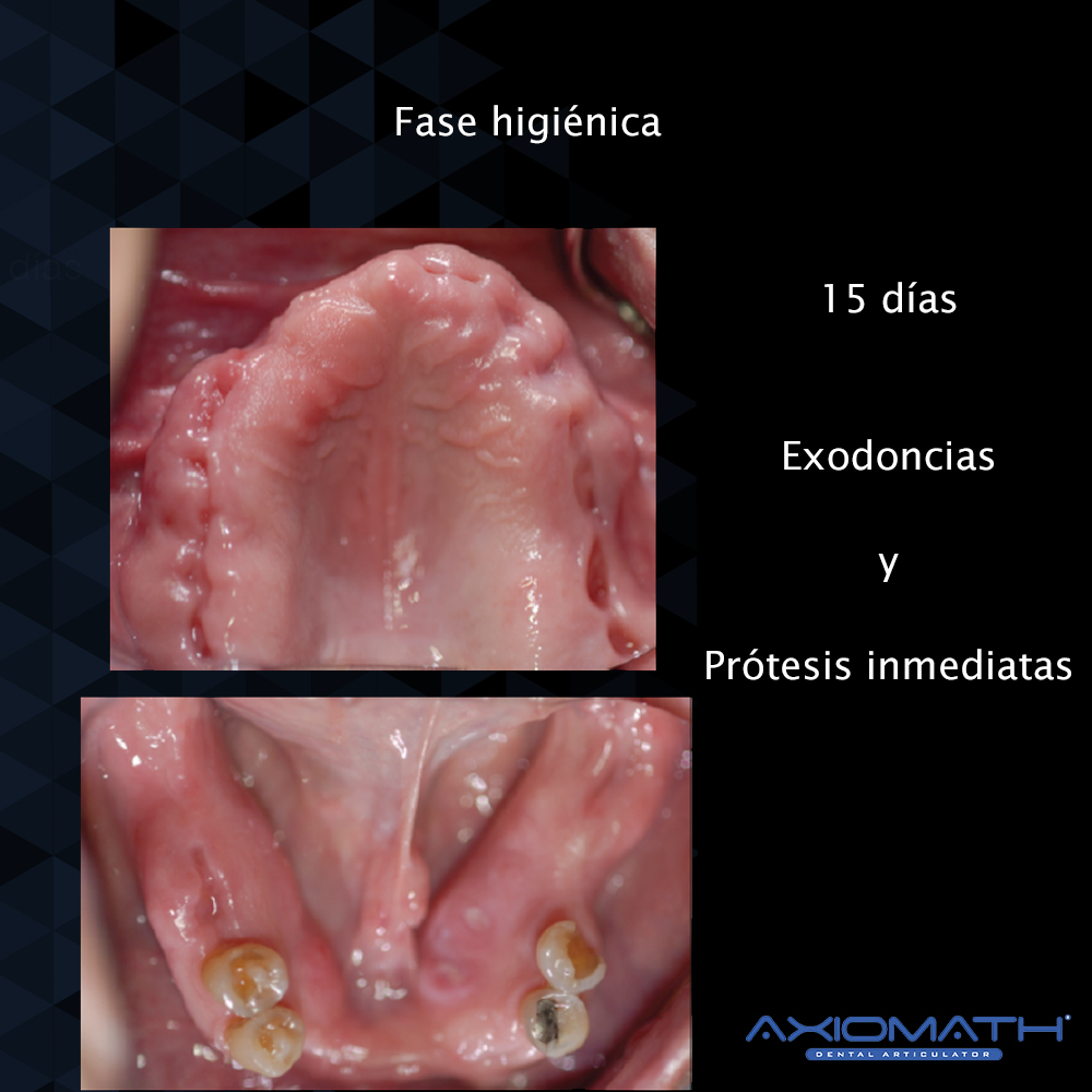 Articulador Dental Axiomath