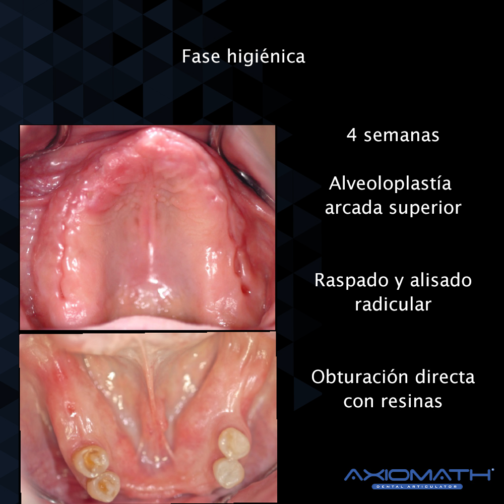 Articulador Dental Axiomath