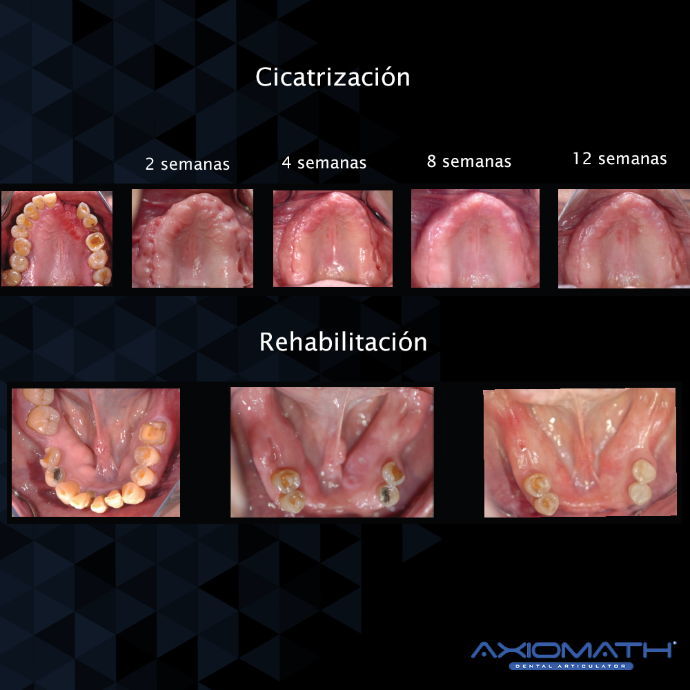 Articulador Dental Axiomath