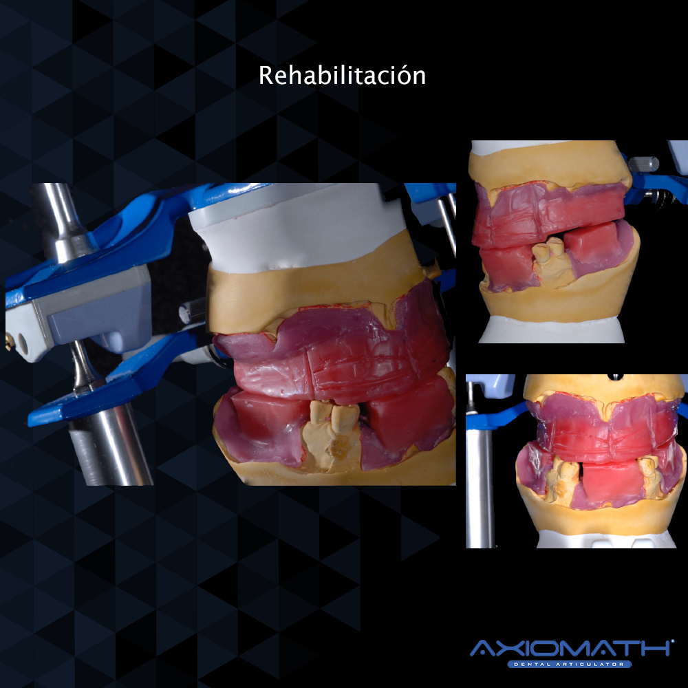 Articulador Dental Axiomath