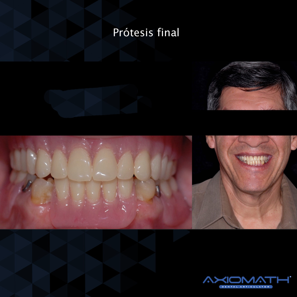 Articulador Dental Axiomath